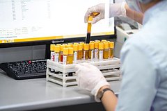 Роспотребнадзор заявил о росте заболеваемости рядом инфекций